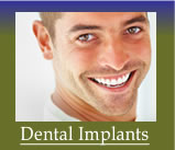 Dental Implants Columbus GA dentist